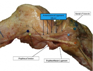 New Knee Ligament Picture - Matt Mcgrath blog