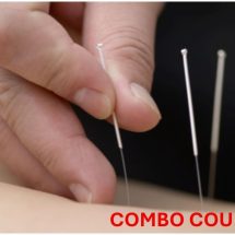 Functional Integrated Dry Needling LEVEL 1&2 COMBO- Toronto ON - April 11-12 and April 25-26, 2026
