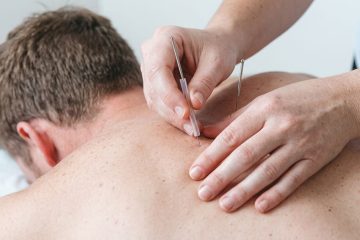 Functional Integrated Needling